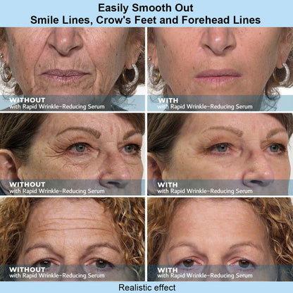 Instant Face Temporary Tightener – Instant visible results in 60 seconds